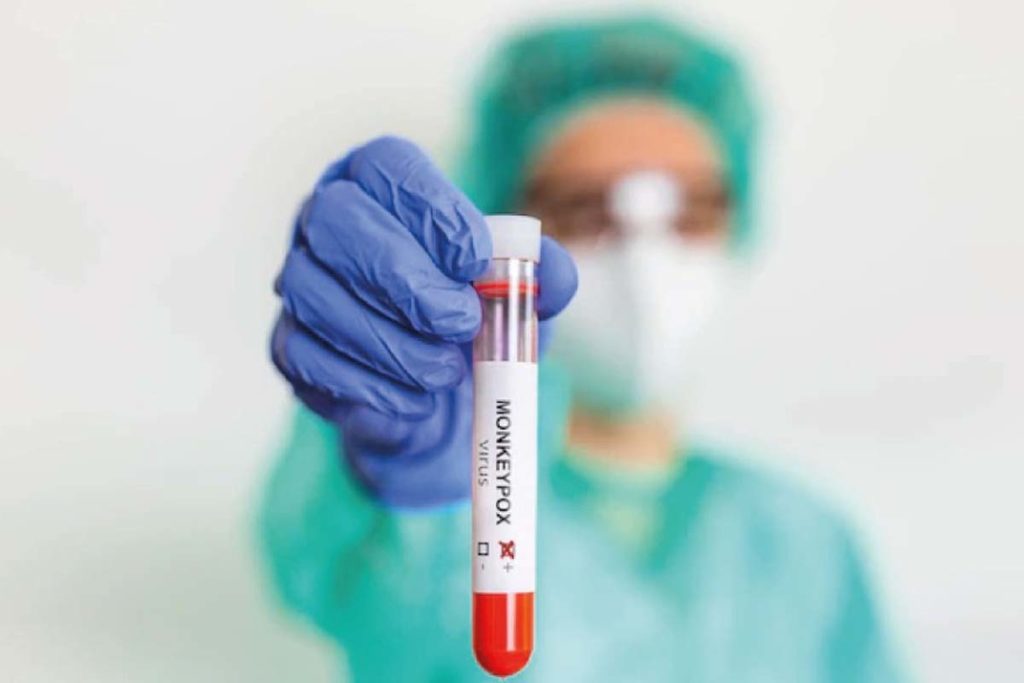 Tocantins conta com 40 casos suspeitos de Monkeypox