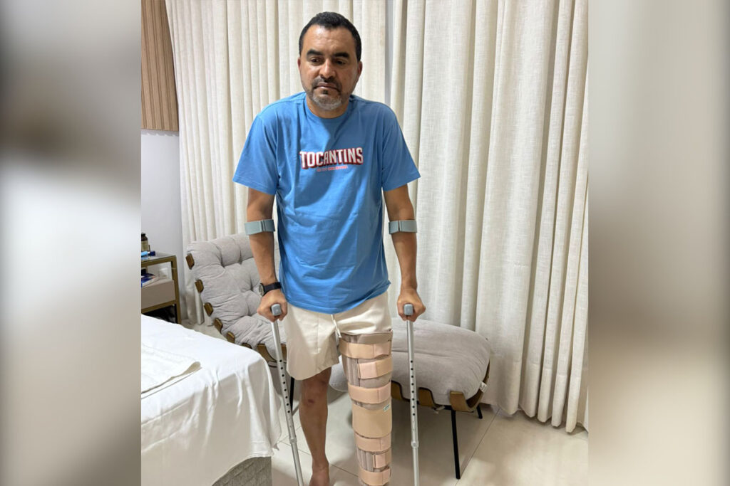 Governador do Tocantins sofrerá cirurgia após lesão grave no joelho durante partida de futebol