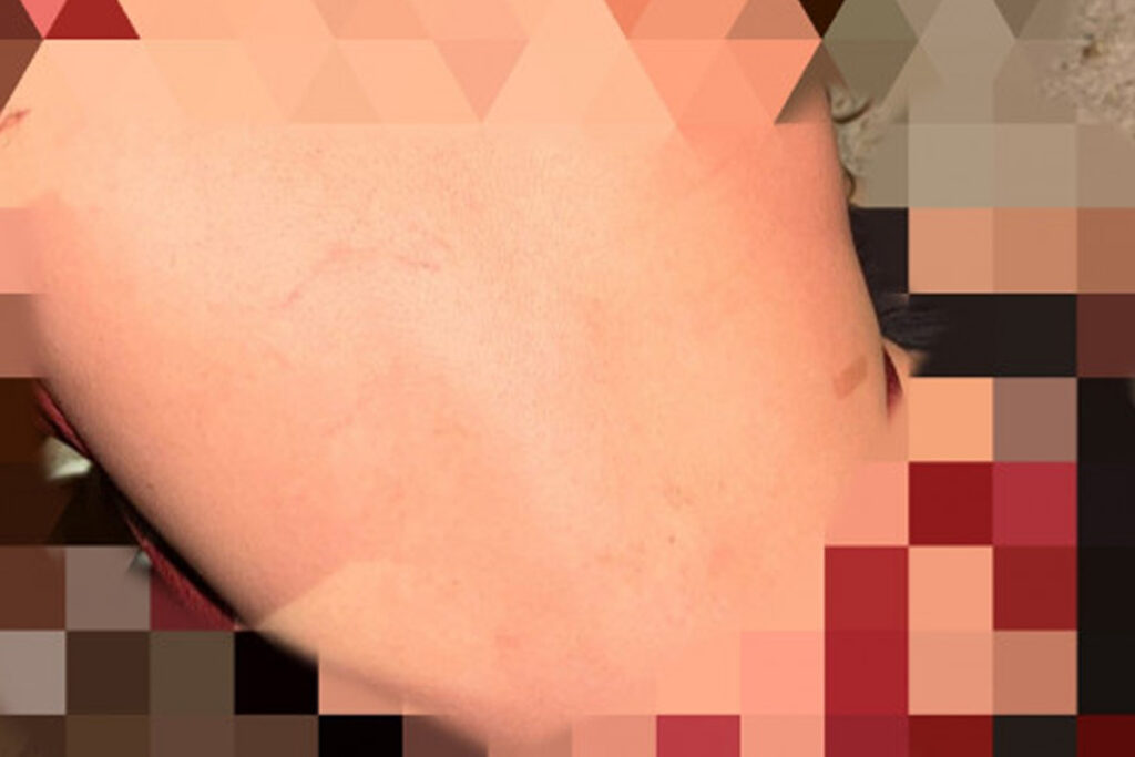 Adolescente de 12 anos é sequestrada e estuprada em Pau D'Arco (TO)