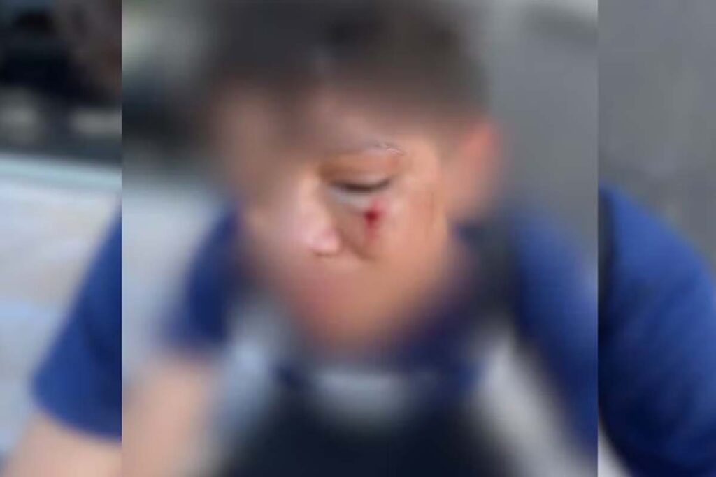 Adolescente de 14 anos é agredido dentro de sala de aula em escola de Dianópolis